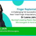 Finger Replantation, A Challenging Yet Successful Surgery for Near Total Finger Amputation performed by Dr. Leena Jain, Mumbai’s leading Plastic Reconstructive Microsurgeon & Hand surgeon