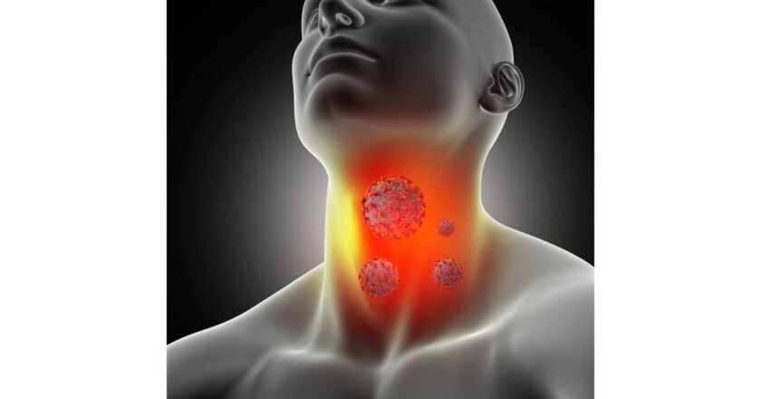 Early Signs and Symptoms of Thyroid Cancer You Should Not Ignore